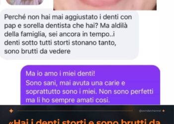 «Hai i denti storti e sono brutti da vedere» Chiara Ferragni risponde all’hater e trasforma la critica in un messaggio sull’accettazione